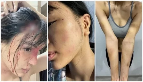 Siêu mẫu Khả Trang bị bạo hành đến " thân tàn ma dại"